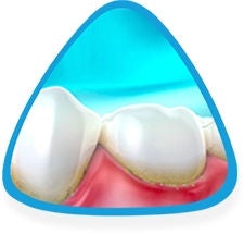 Sağlıksız diş etleri