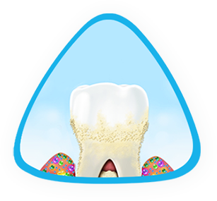 İleri evre diş eti sorunları